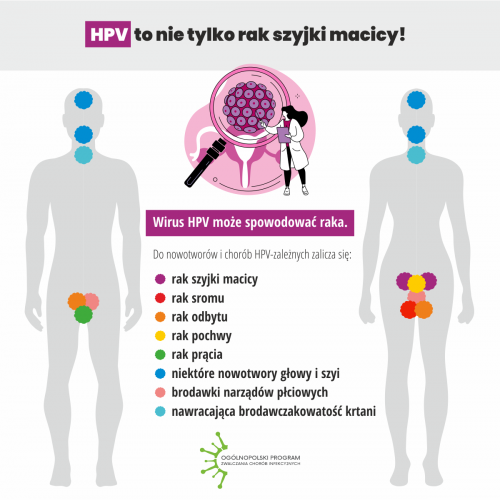 Szczepienia-przeciw-HPV infograph 2